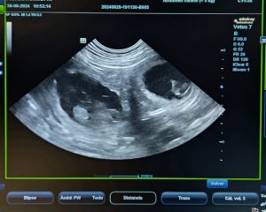 Cachorro de Pastor Australiano en una Ecografía abdominal